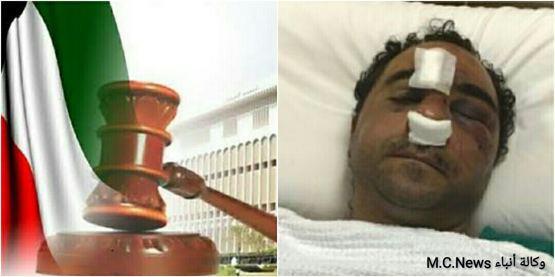 القضاء الكويتى ينتصر للعدالة في قضية الإعتداء علي شاب مصرى بالكويت